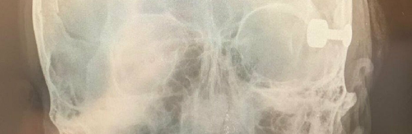 ����: inalmaty.kz