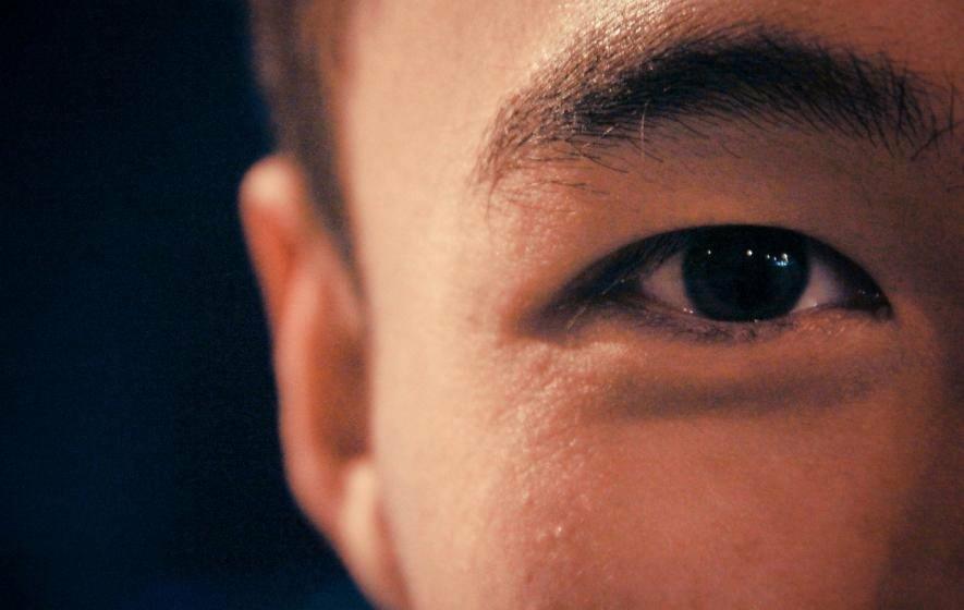 попали лазером в глаз. эксимерные лазеры глаз. фрк ласик. попали лазером в глаз. коррекция зрения лазером.